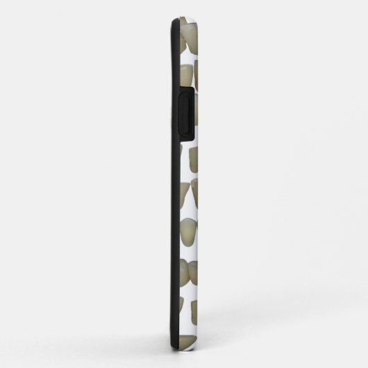 歯科医歯科歯列矯正腐敗歯口 Case-Mate iPhoneケース (裏面/右)