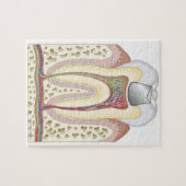 歯科用充填イラストレーション ジグソーパズル (横)