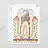 歯科用充填イラストレーション ポストカード (正面/裏面)