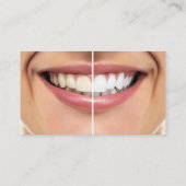 歯科用歯の美白アポイントメントカード 名刺 (裏面)