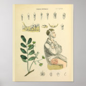 歯科用歯の顎ヴィンテージ解剖学プリント ポスター (正面)