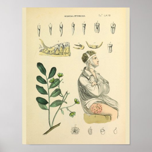 歯科用歯の顎ヴィンテージ解剖学プリント ポスター (正面)