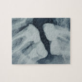 歯科用X線のクローズアップ ジグソーパズル (横)