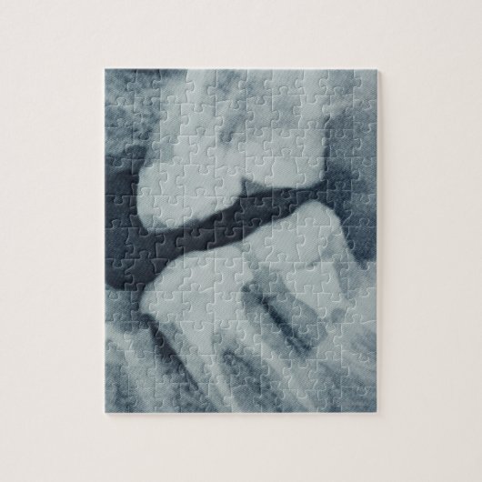 歯科用X線のクローズアップ ジグソーパズル (縦)