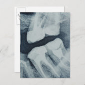 歯科用X線のクローズアップ ポストカード (正面/裏面)