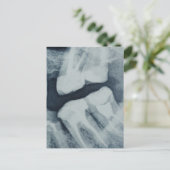 歯科用X線のクローズアップ ポストカード (スタンド正面)