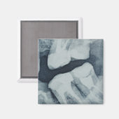 歯科用X線のクローズアップ マグネット (正面/裏面)