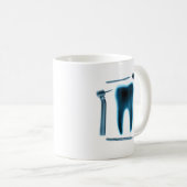 歯科衛生士歯科補助歯X線歯 コーヒーマグカップ (正面右)