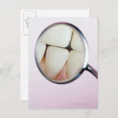 歯科鏡に反射した歯のクローズアップ ポストカード (正面/裏面)