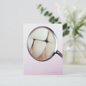 歯科鏡に反射した歯のクローズアップ ポストカード (スタンド正面)