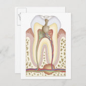 歯髄根膿瘍 ポストカード (正面/裏面)