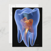歯、モルの透明な横断面 ポストカード (正面/裏面)