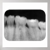 歯（充填） ポスター (正面)
