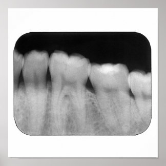 歯（充填） ポスター