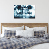 歯X線 キャンバスプリント (インサイチュ (寝室))