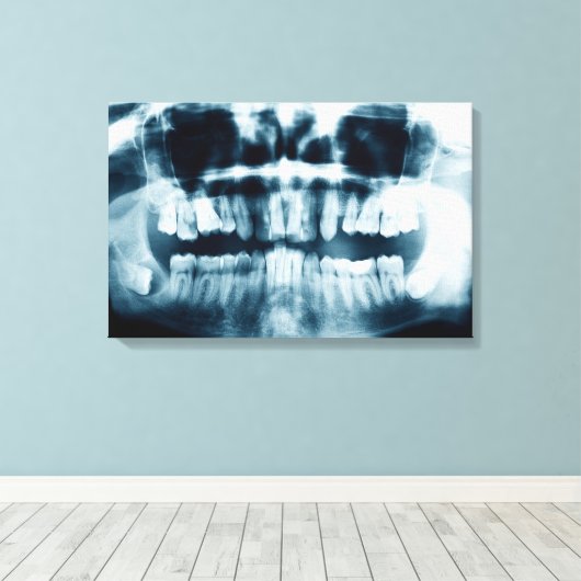 歯X線 キャンバスプリント (インサイチュ (ウッドフロア))