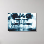 歯X線 キャンバスプリント (正面)