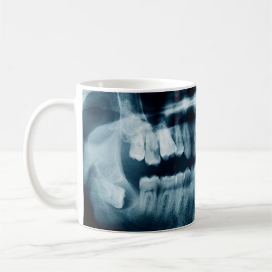 歯X線 コーヒーマグカップ (左)