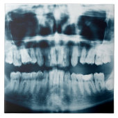 歯X線 タイル (正面)