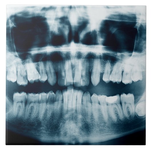 歯X線 タイル (正面)