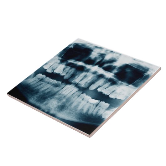 歯X線 タイル (側面)