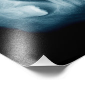 歯X線 フォトプリント            (角)