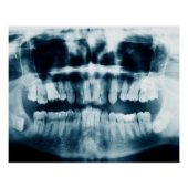 歯X線 ポスター (正面)