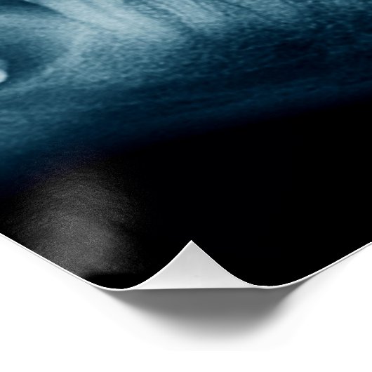 歯X線 ポスター (コーナー)