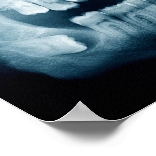 歯X線 ポスター (角)