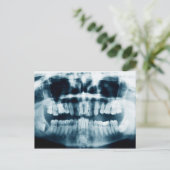 歯X線 ポストカード (スタンド正面)