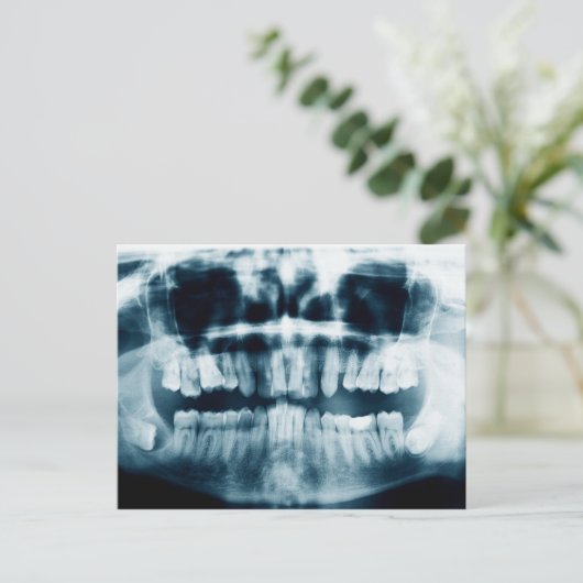 歯X線 ポストカード (スタンド正面)