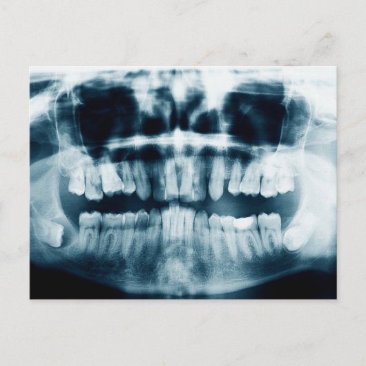 歯X線 ポストカード (正面)