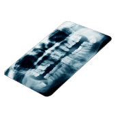 歯X線 マグネット (左側)