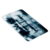 歯X線 マグネット (右側)