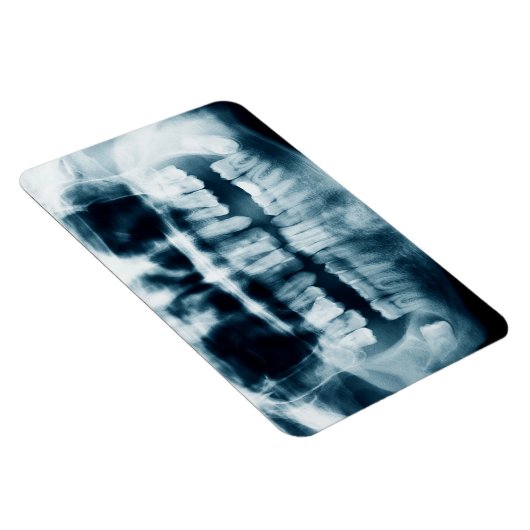 歯X線 マグネット (右側)