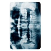 歯X線 マグネット (縦)