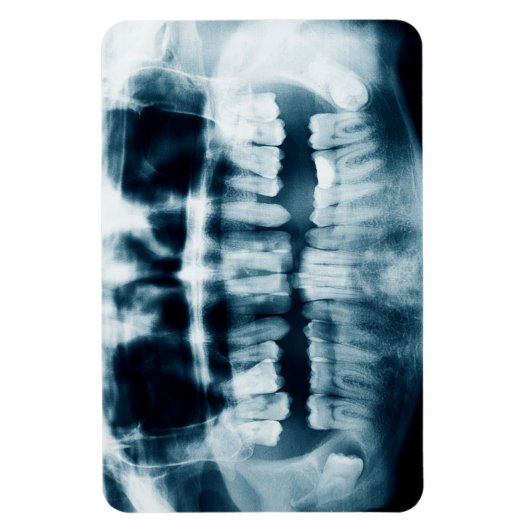 歯X線 マグネット (縦)