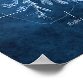 気管と肺のブロンチ解剖学アートデコール ポスター (角)