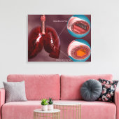 気管の肺との断面積 キャンバスプリント (インサイチュ (リビング))