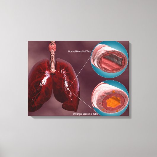気管の肺との断面積 キャンバスプリント (正面)