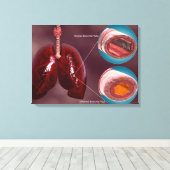 気管の肺との断面積 キャンバスプリント (インサイチュ (ウッドフロア))