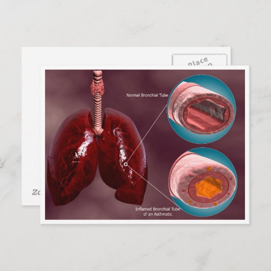気管の肺との断面積 ポストカード (正面/裏面)