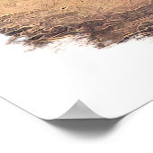 気管支ライダープリント ポスター (角)