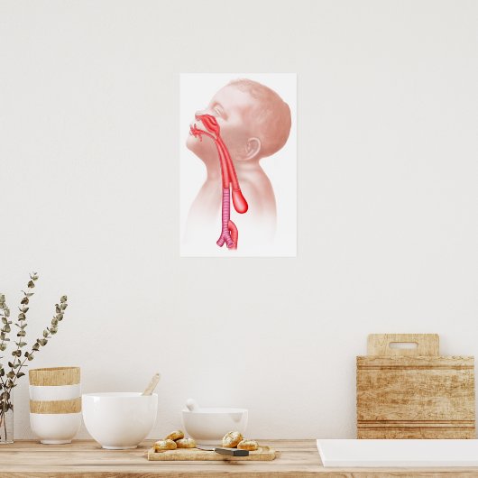 気管食道瘻構造 ポスター (キッチン)