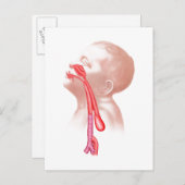 気管食道瘻構造 ポストカード (正面/裏面)