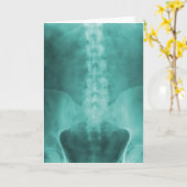 水のデジタルX線の芸術の挨拶状 カード (黄色い花)