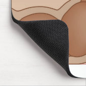 永久結腸瘻造設術 マウスパッド (コーナー)