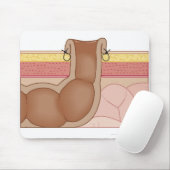 永久結腸瘻造設術 マウスパッド (マウス)