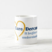 治療のDercumのマグ コーヒーマグカップ (中央)