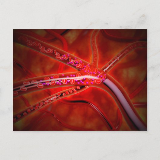 注射される医学の顕微鏡的見解 ポストカード (正面)